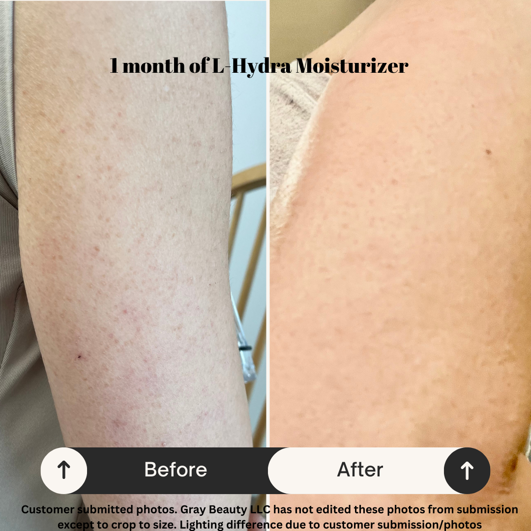 L-Hydra Moisturizer